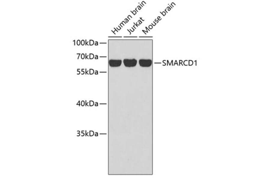 Western Blot - Anti-SMARCD1 Antibody (A2273) - Antibodies.com