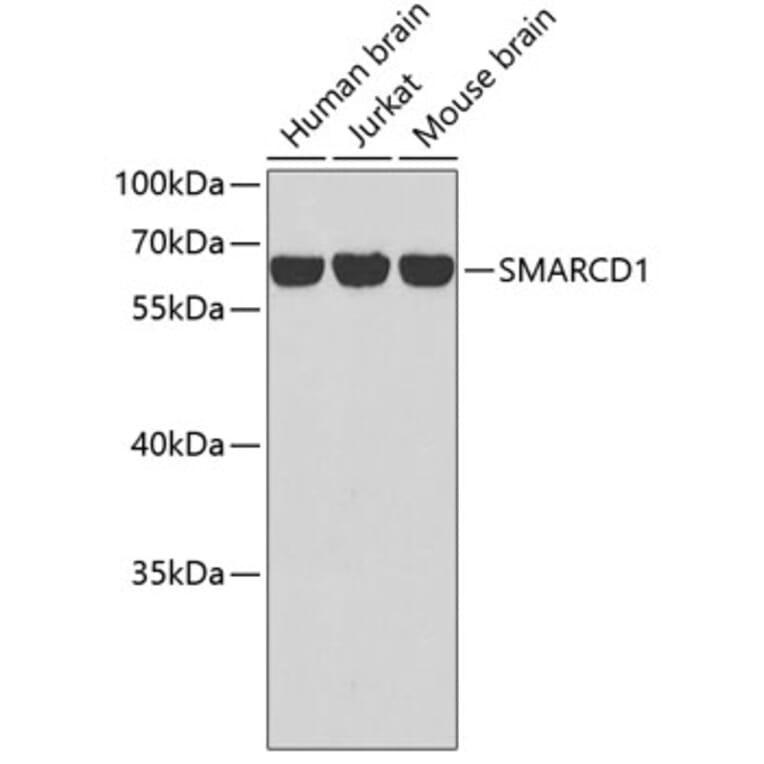 Western Blot - Anti-SMARCD1 Antibody (A2273) - Antibodies.com