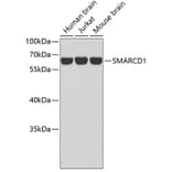 Western Blot - Anti-SMARCD1 Antibody (A2273) - Antibodies.com