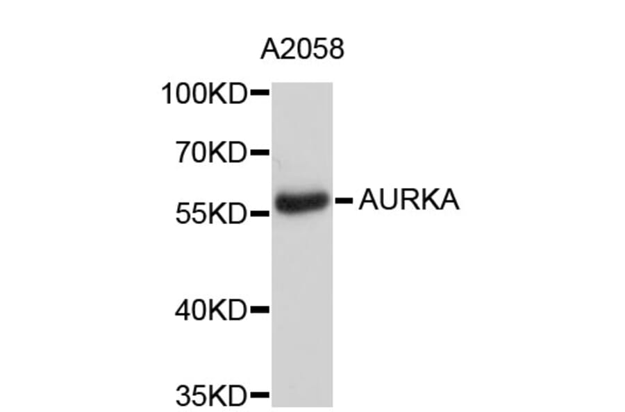 Western Blot - Anti-AURKA Antibody (A2276) - Antibodies.com