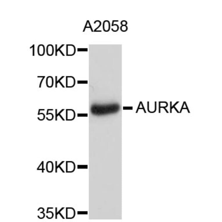 Western Blot - Anti-AURKA Antibody (A2276) - Antibodies.com