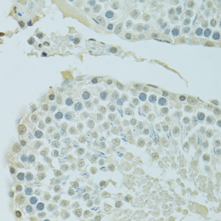 Immunohistochemistry - Anti-BRD3 Antibody (A9025) - Antibodies.com