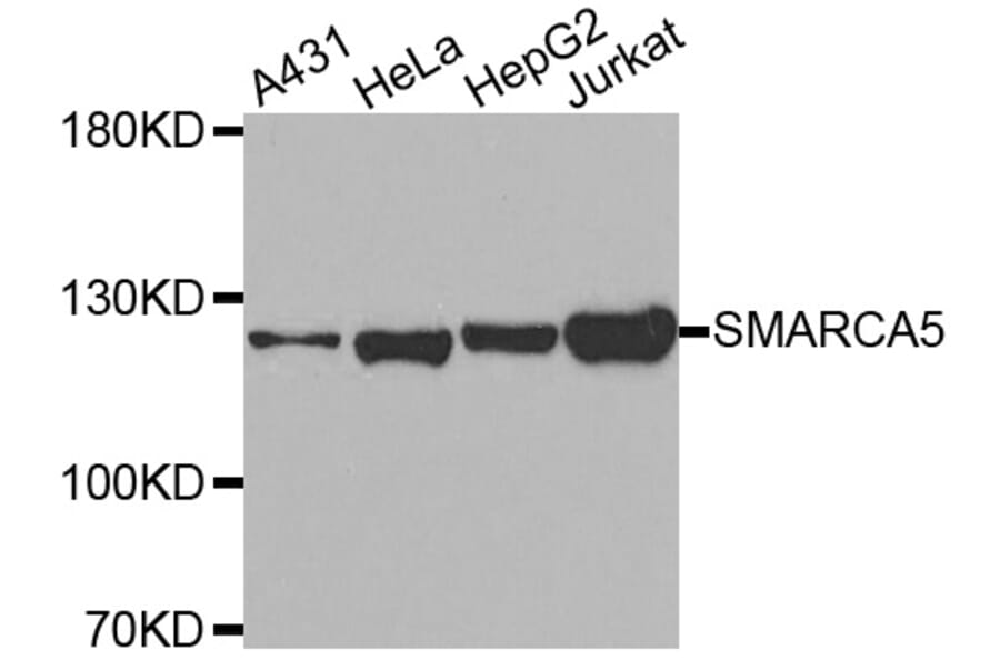 Western Blot - Anti-SMARCA5 Antibody (A2281) - Antibodies.com