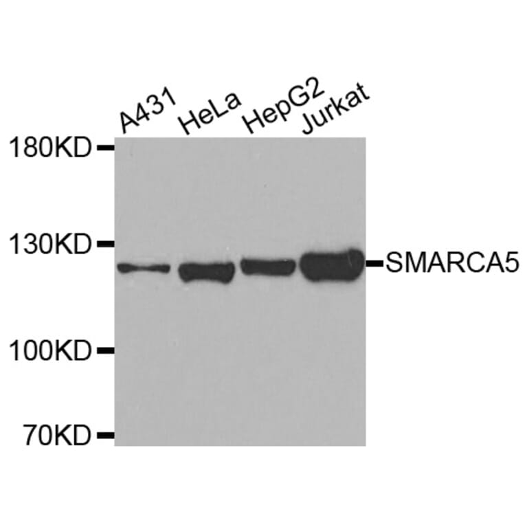Western Blot - Anti-SMARCA5 Antibody (A2281) - Antibodies.com