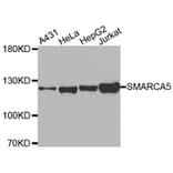 Western Blot - Anti-SMARCA5 Antibody (A2281) - Antibodies.com