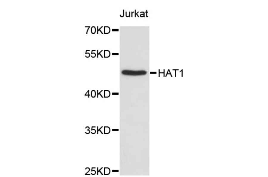 Western Blot - Anti-HAT1 Antibody (A2282) - Antibodies.com