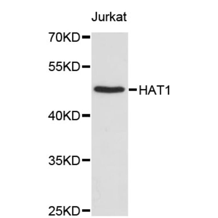 Western Blot - Anti-HAT1 Antibody (A2282) - Antibodies.com