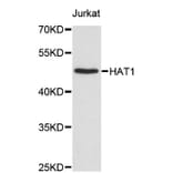 Western Blot - Anti-HAT1 Antibody (A2282) - Antibodies.com