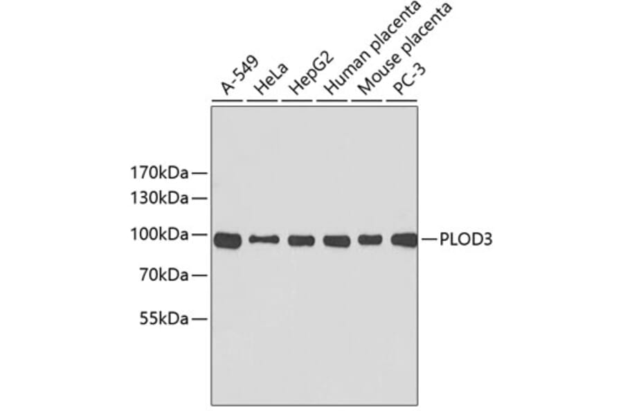 Western Blot - Anti-PLOD3 Antibody (A2285) - Antibodies.com
