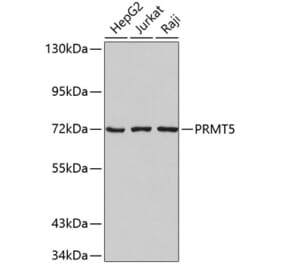 Western Blot - Anti-PRMT5 Antibody (A9029) - Antibodies.com
