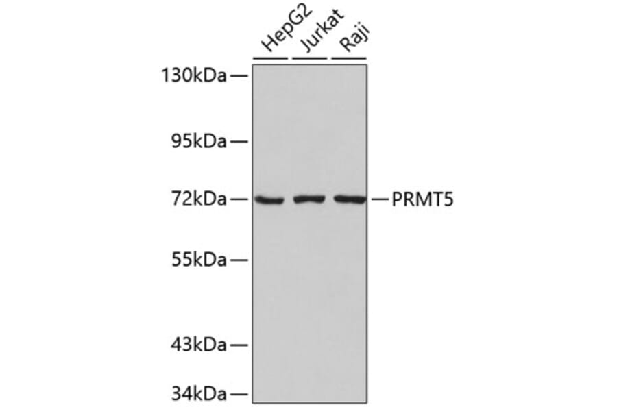 Western Blot - Anti-PRMT5 Antibody (A9029) - Antibodies.com
