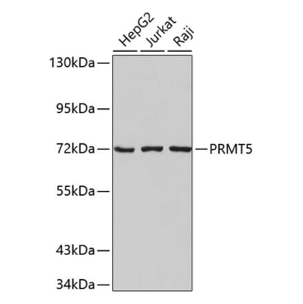 Western Blot - Anti-PRMT5 Antibody (A9029) - Antibodies.com