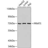 Western Blot - Anti-PRMT5 Antibody (A9029) - Antibodies.com