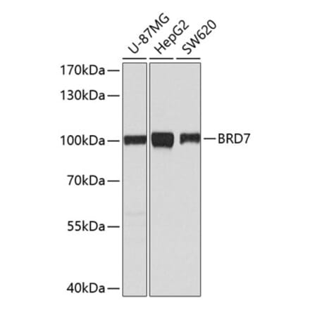 Western Blot - Anti-BRD7 Antibody (A9032) - Antibodies.com