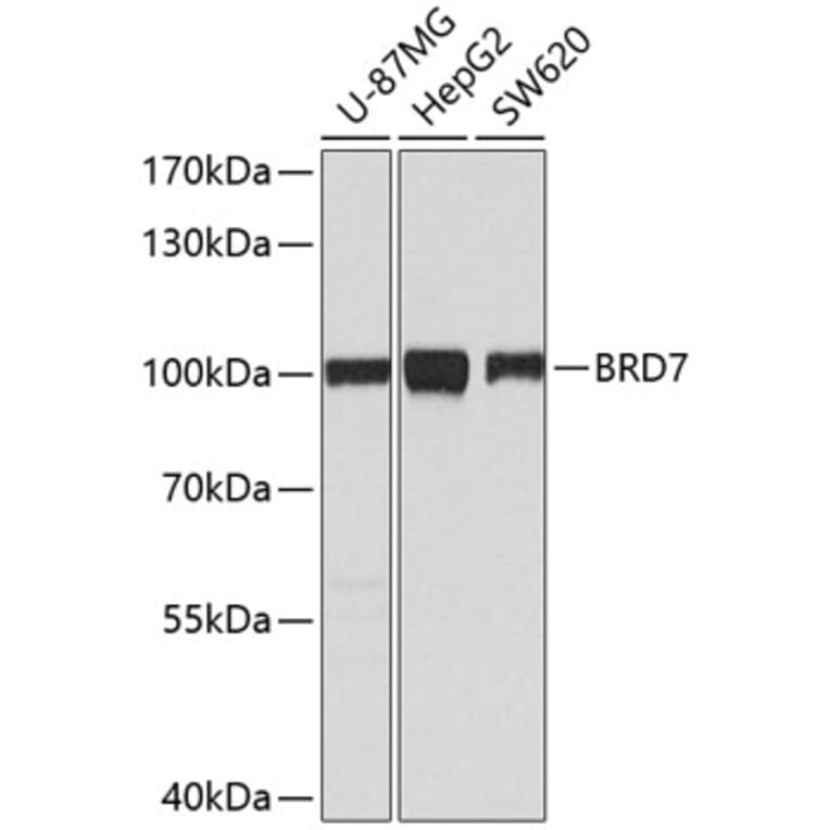Western Blot - Anti-BRD7 Antibody (A9032) - Antibodies.com