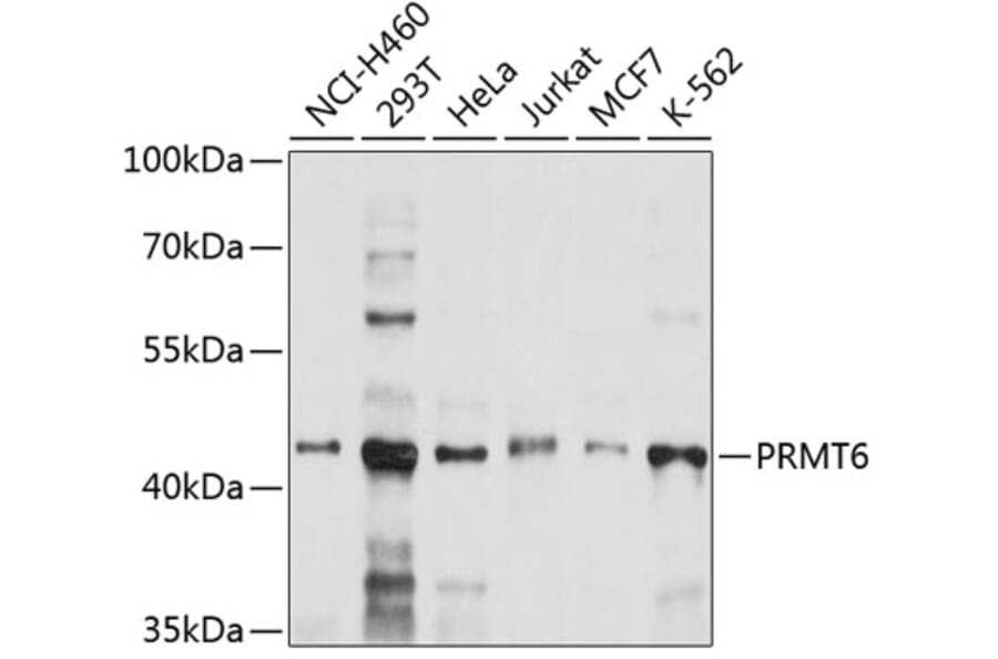 Western Blot - Anti-PRMT6 Antibody (A9034) - Antibodies.com