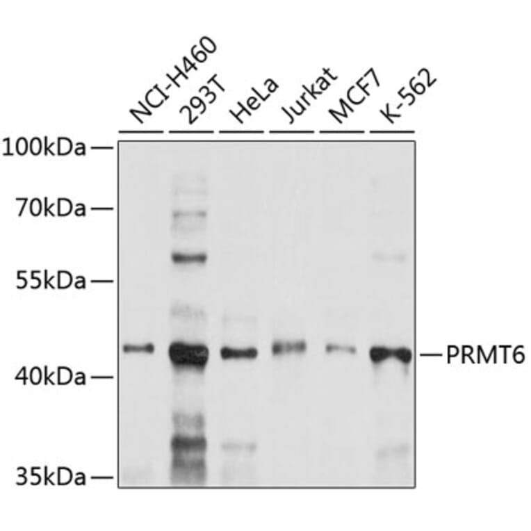 Western Blot - Anti-PRMT6 Antibody (A9034) - Antibodies.com