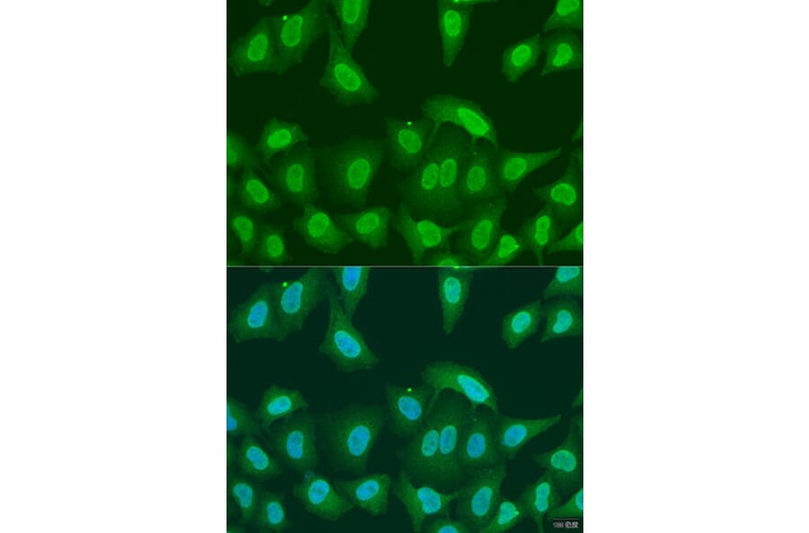 Immunofluorescence - Anti-PRMT6 Antibody (A9034) - Antibodies.com