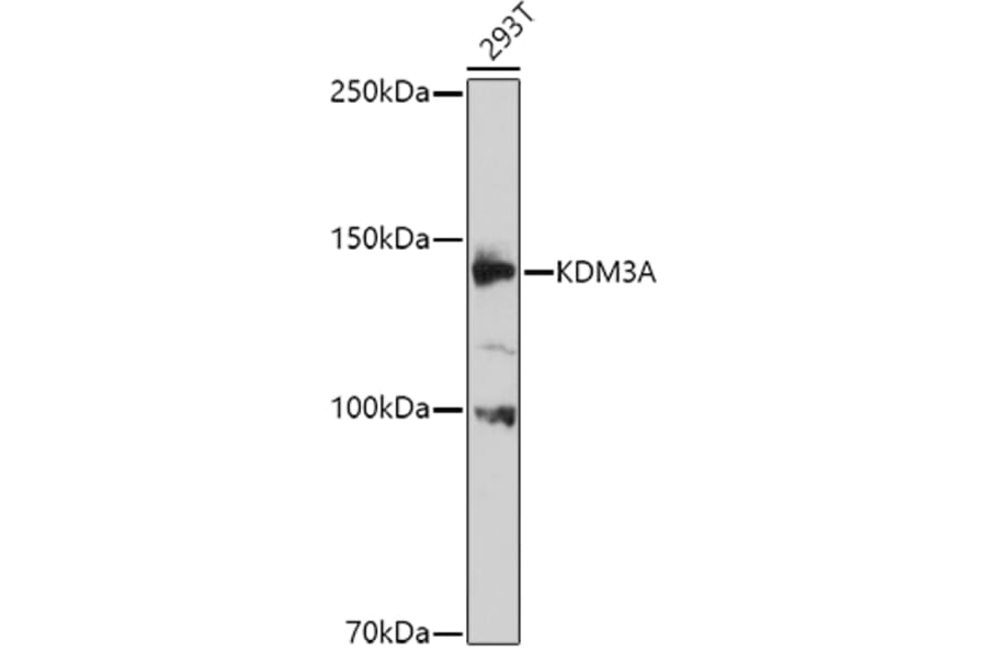 Western Blot - Anti-KDM3A/JHDM2A Antibody (A9035) - Antibodies.com