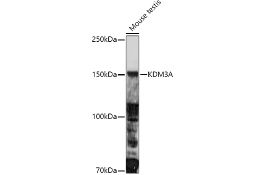 Western Blot - Anti-KDM3A/JHDM2A Antibody (A9035) - Antibodies.com