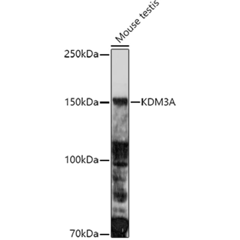 Western Blot - Anti-KDM3A/JHDM2A Antibody (A9035) - Antibodies.com