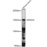 Western Blot - Anti-KDM3A/JHDM2A Antibody (A9035) - Antibodies.com
