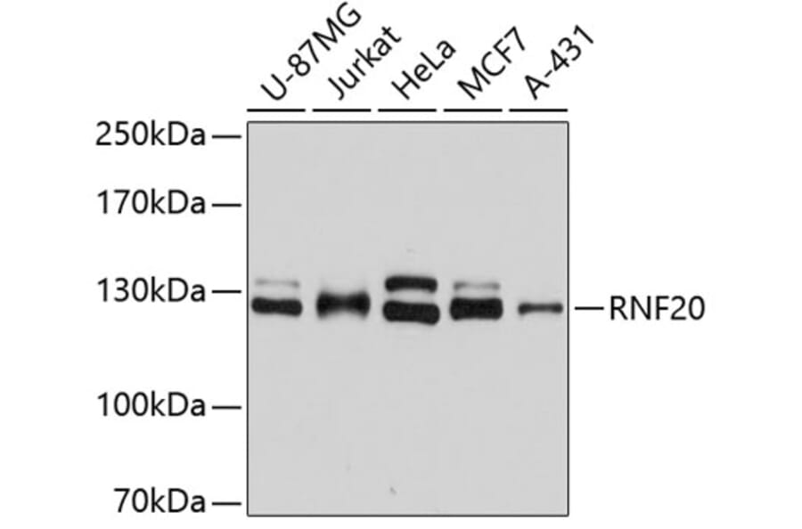 Western Blot - Anti-RNF20 Antibody (A2325) - Antibodies.com