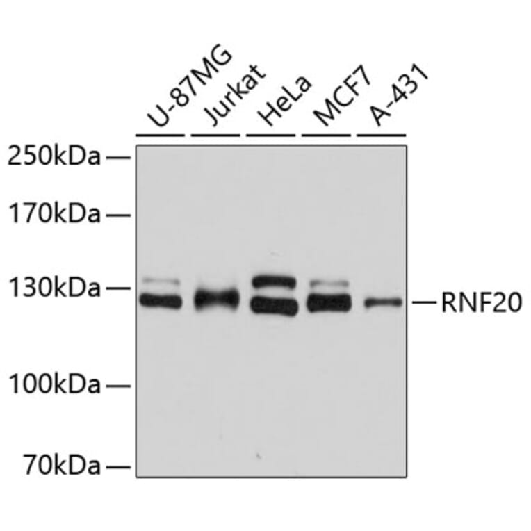 Western Blot - Anti-RNF20 Antibody (A2325) - Antibodies.com