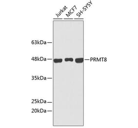 Western Blot - Anti-PRMT8 Antibody (A9037) - Antibodies.com