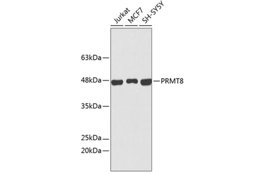 Western Blot - Anti-PRMT8 Antibody (A9037) - Antibodies.com