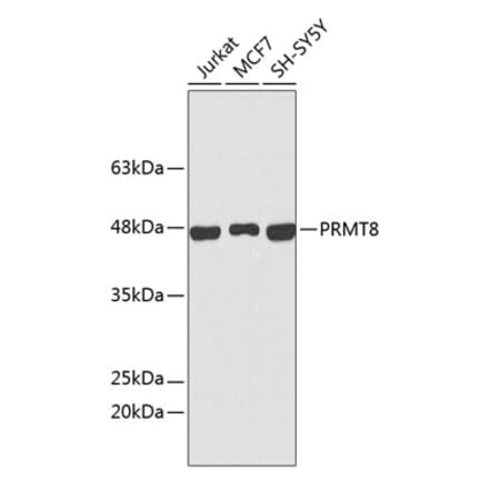 Western Blot - Anti-PRMT8 Antibody (A9037) - Antibodies.com