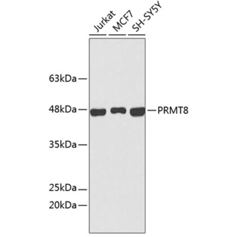 Western Blot - Anti-PRMT8 Antibody (A9037) - Antibodies.com