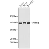 Western Blot - Anti-PRMT8 Antibody (A9037) - Antibodies.com