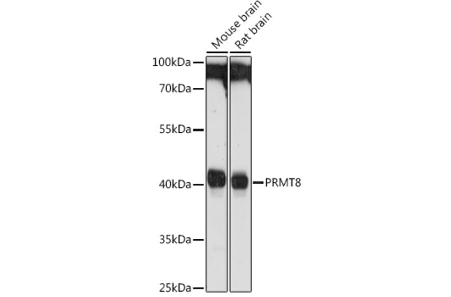 Western Blot - Anti-PRMT8 Antibody (A9037) - Antibodies.com