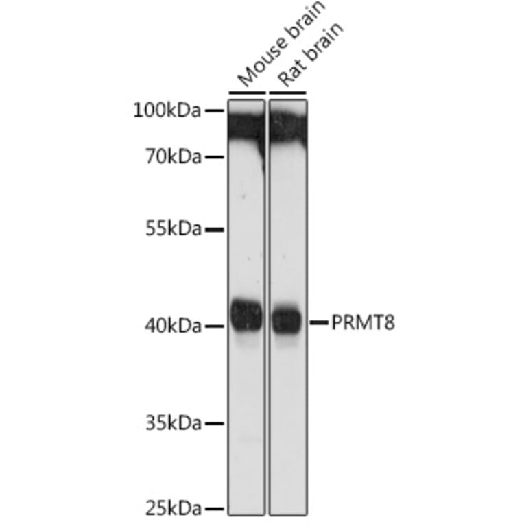 Western Blot - Anti-PRMT8 Antibody (A9037) - Antibodies.com