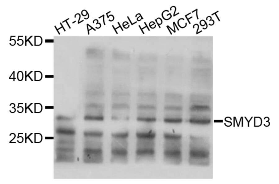 Western Blot - Anti-SMYD3 Antibody (A2329) - Antibodies.com