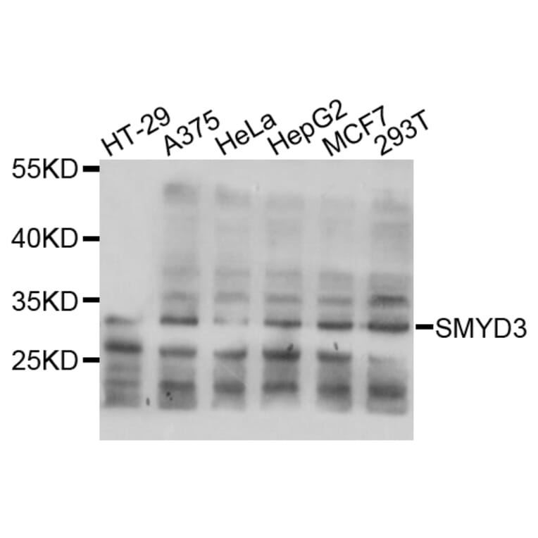 Western Blot - Anti-SMYD3 Antibody (A2329) - Antibodies.com