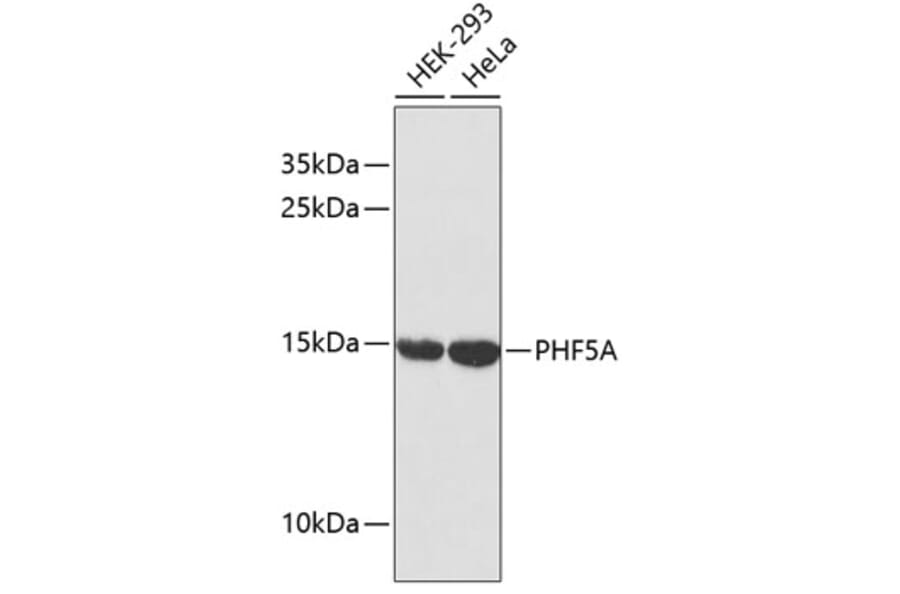 Western Blot - Anti-PHF5A Antibody (A2333) - Antibodies.com