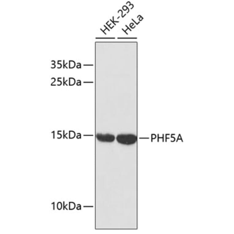 Western Blot - Anti-PHF5A Antibody (A2333) - Antibodies.com