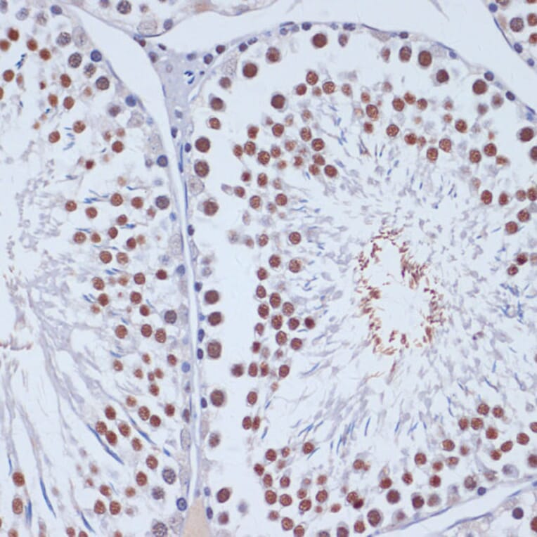 Immunohistochemistry - Anti-Dnmt3L Antibody (A9041) - Antibodies.com