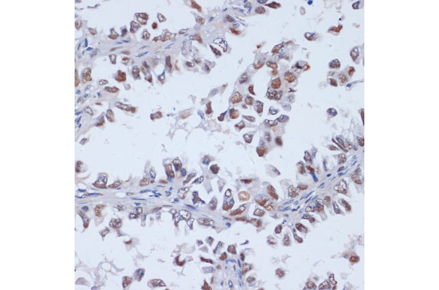 Immunohistochemistry - Anti-Dnmt3L Antibody (A9041) - Antibodies.com