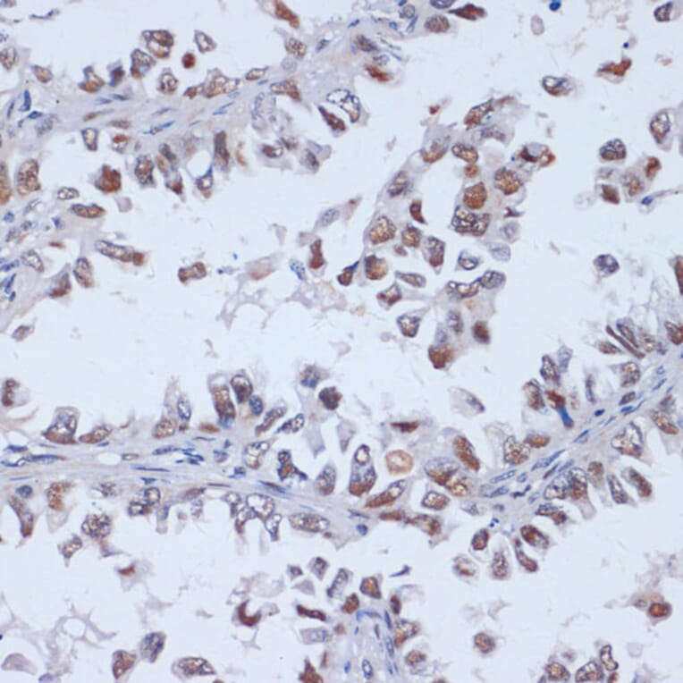 Immunohistochemistry - Anti-Dnmt3L Antibody (A9041) - Antibodies.com