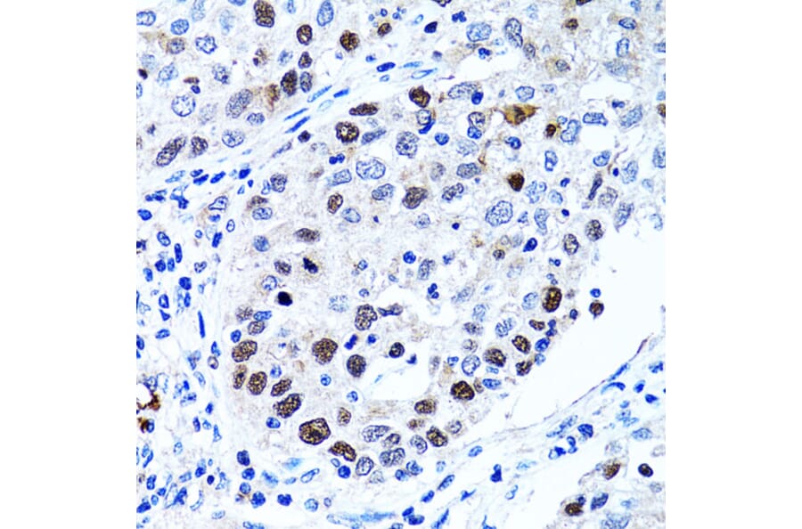 Immunohistochemistry - Anti-UHRF1 Antibody (A9042) - Antibodies.com