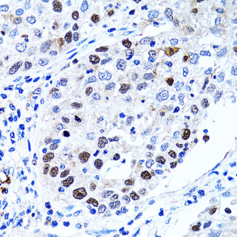 Immunohistochemistry - Anti-UHRF1 Antibody (A9042) - Antibodies.com