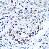 Immunohistochemistry - Anti-UHRF1 Antibody (A9042) - Antibodies.com