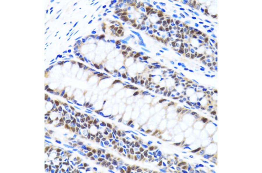 Immunohistochemistry - Anti-UHRF1 Antibody (A9042) - Antibodies.com