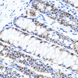 Immunohistochemistry - Anti-UHRF1 Antibody (A9042) - Antibodies.com