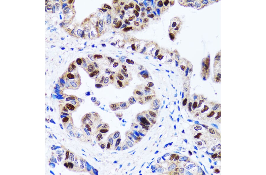 Immunohistochemistry - Anti-UHRF1 Antibody (A9042) - Antibodies.com