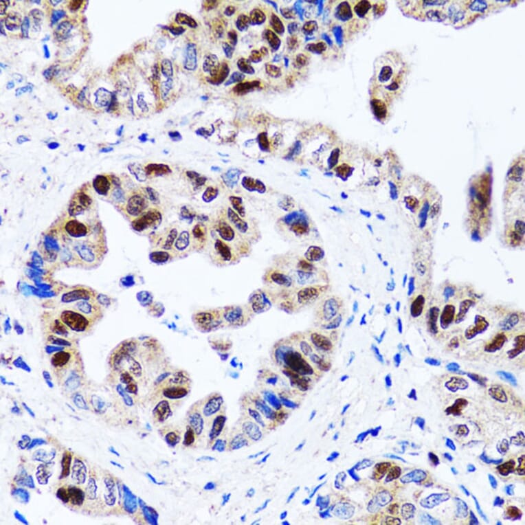 Immunohistochemistry - Anti-UHRF1 Antibody (A9042) - Antibodies.com