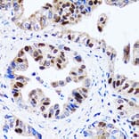 Immunohistochemistry - Anti-UHRF1 Antibody (A9042) - Antibodies.com
